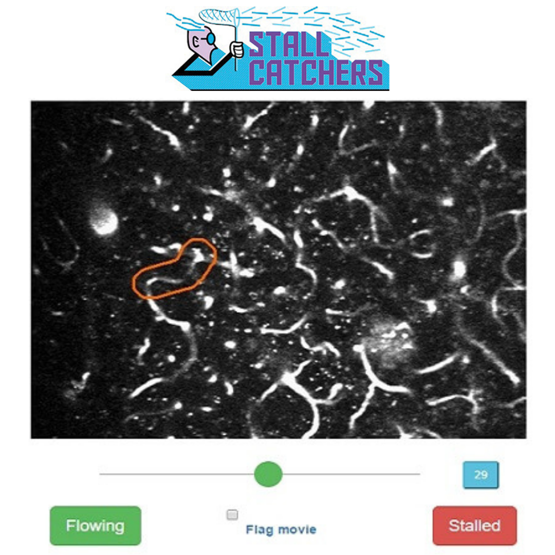 A screenshot from the Stall Catchers citizen science game.